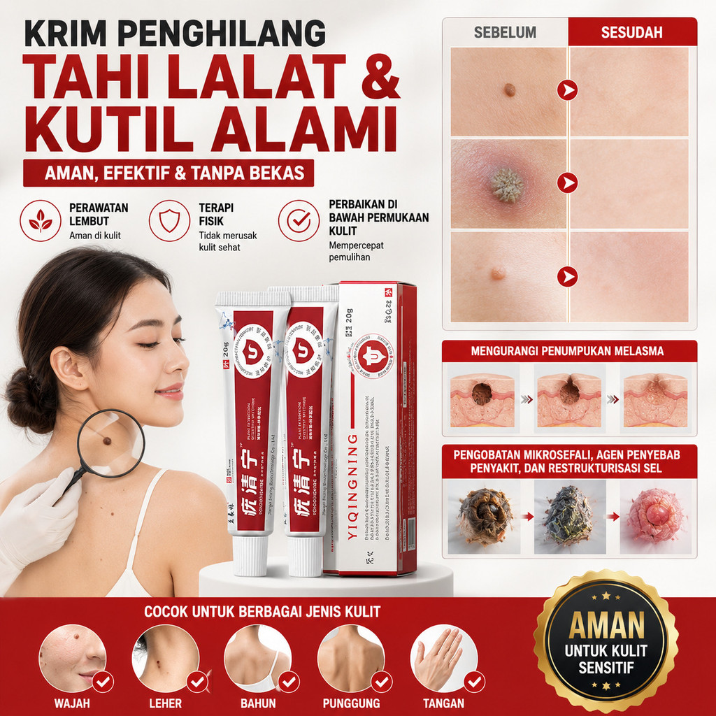 Obat Kutil | Krim Penghilang Kutil | Asam Salisilat | Krim Penghilang Kutil Asam Salisilat | Salep P