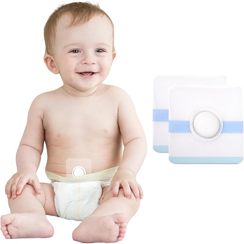 5Pcs Penutup Pusar Bayi Bodong / Sabuk Terapi Pusar Bayi / Patch Anti Pusar Bodong