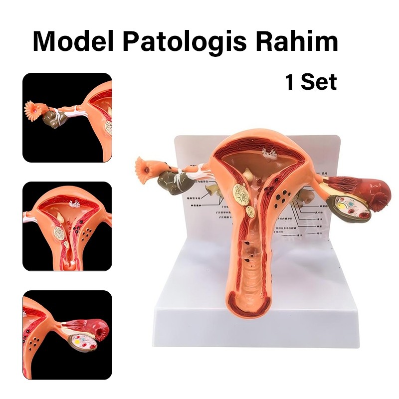 Model Alat Peraga Uterus Ovary Anatomical Pendidikan Model Patologis Uterus Ovarium