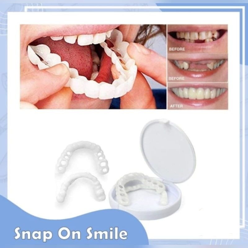 FLAS SALE Snap On Smile Veneer Instan Gigi Palsu Tiruan Kesehatan Mulut