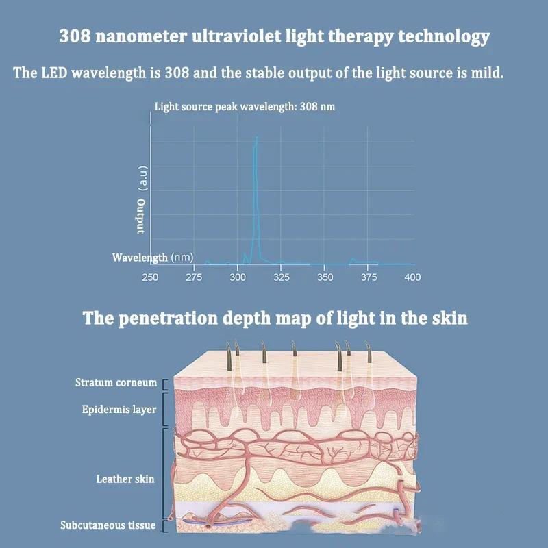 Lampu Fototerapi UVB 308nm, Perangkat Cahaya Excimer untuk Perawatan Kulit Vitiligo, Psoriasis, Eksi