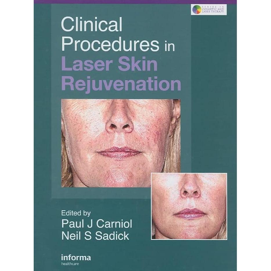 [Full Color/BW] Clinical Procedures in Laser Skin Rejuvenation - Isi Full Color