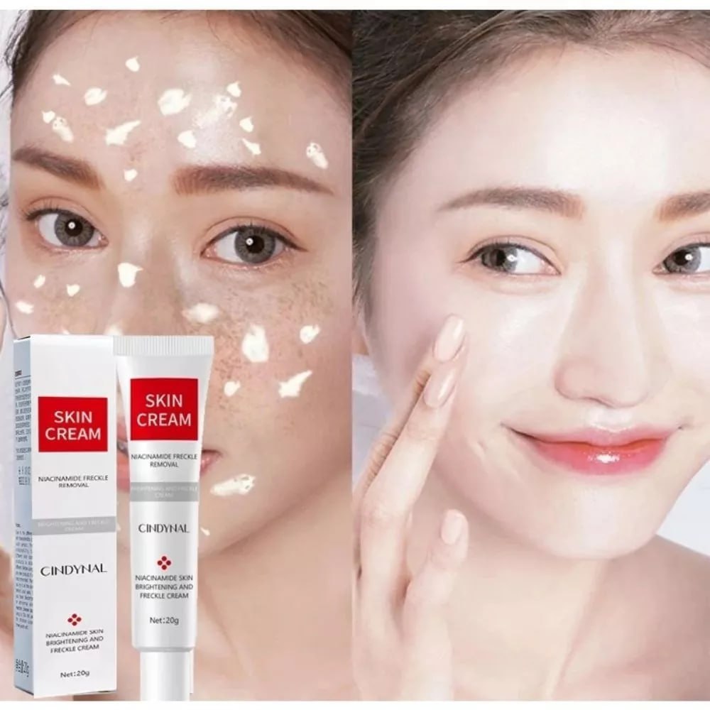 CINDYNAL Skin Cream Freckle Removal / Krim Wajah Pria & Wanita Glowing Cepat Siang Malam | SM