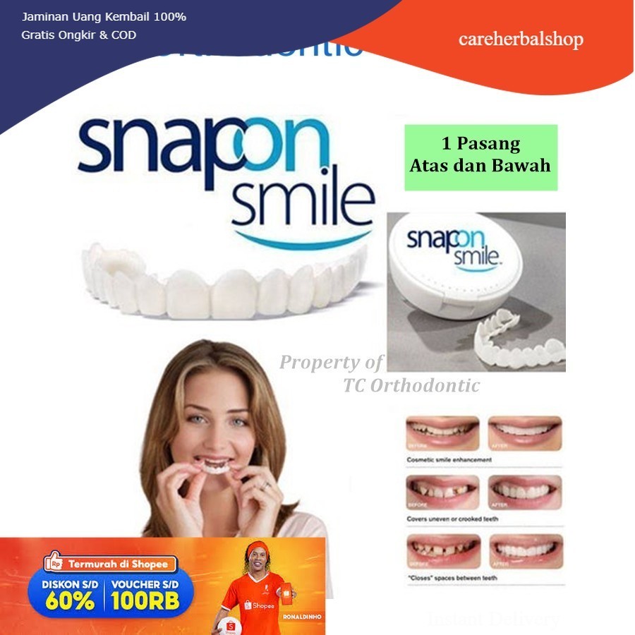 SOLUSI GIGI OMPONG  Snap On Smile Gigi Palsu Atas Bawah Pria Wanita Snap on Smile Veneers Gigi Perfe