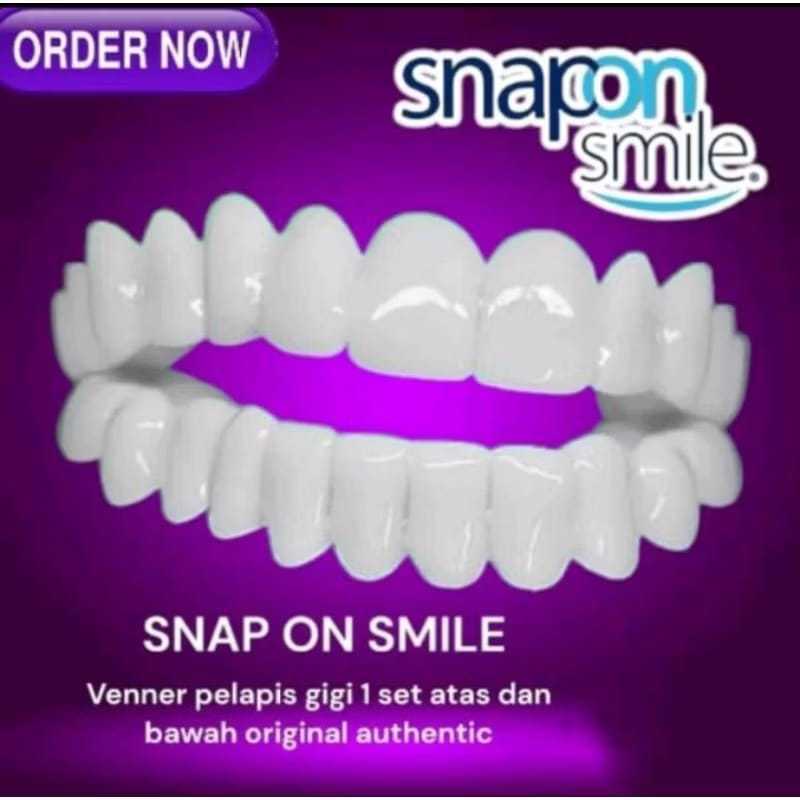 PROMO NEWWW Snap On Smile Gigi Instan – Veneer Lepasan Natural Putih Rapi original