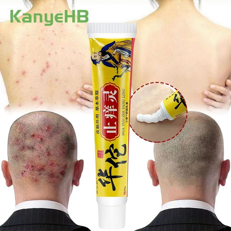 1Pcs Psoriasis Ointment Pruritus Eczema Dermatitis Herbal Antibacterial Cream Eczematoid Anti-itchin