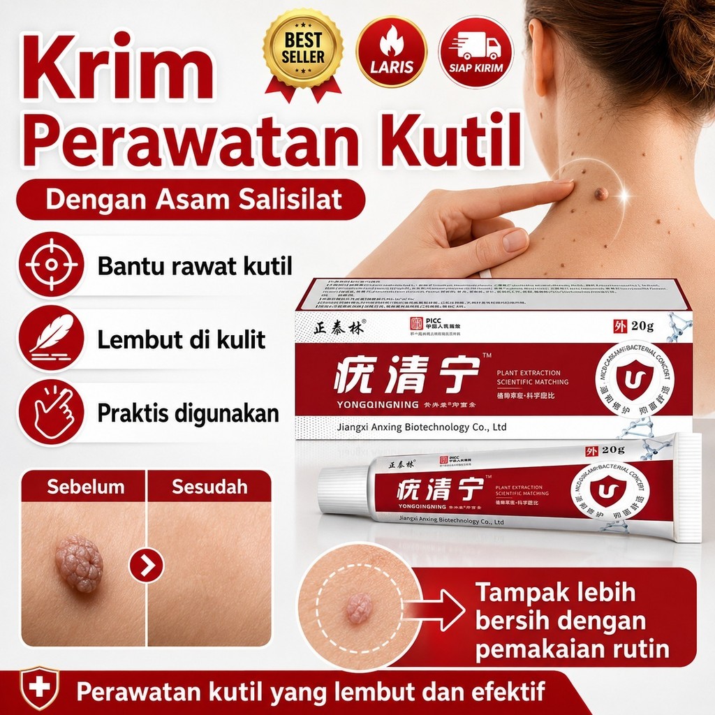 [Pengiriman 24 Jam]Salep Penghilang Kutil Asam Salisilat - Anti Bakteri, Mengobati & Menghilangkan J