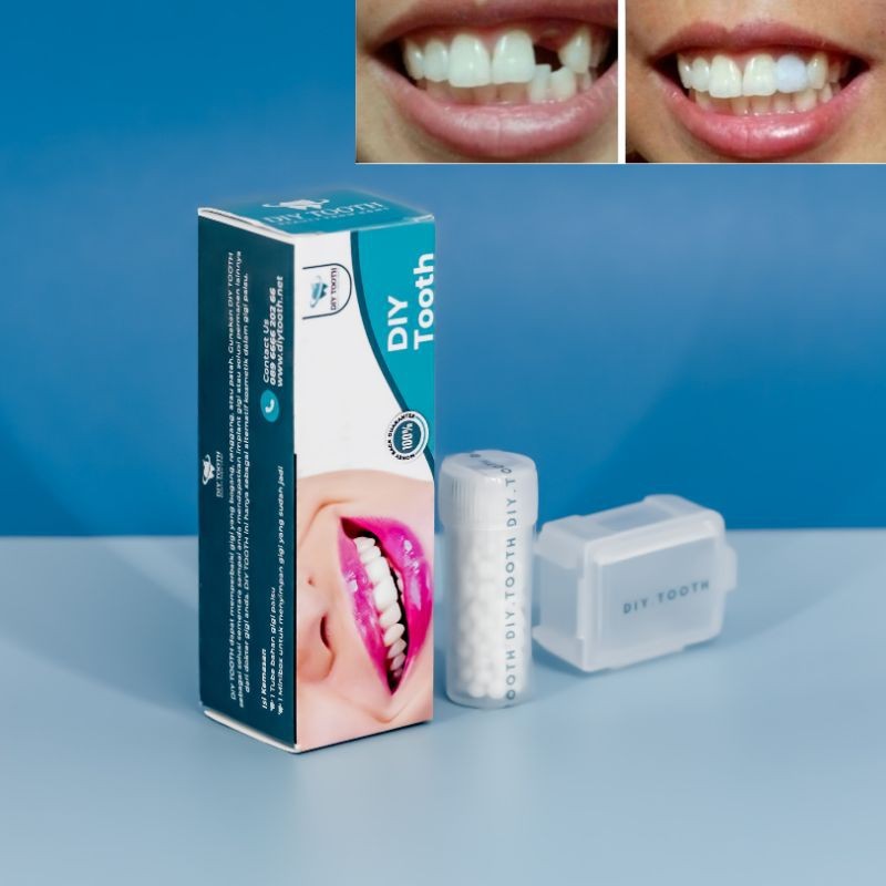 ReadyDIY TOOTH gigi palsu sementara / bisa dibentuk sendiri / veener sementara /  lem gigi / temptoo