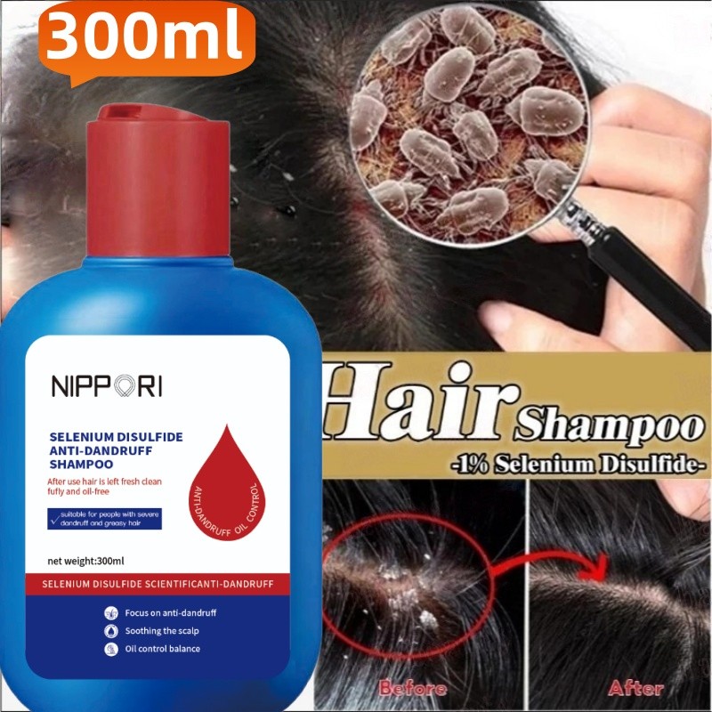 300ml Anti Gatal Pengobatan Ketombeshampoo Penghilang Ketombe Itch Clear Malassezia Pengendalian Min