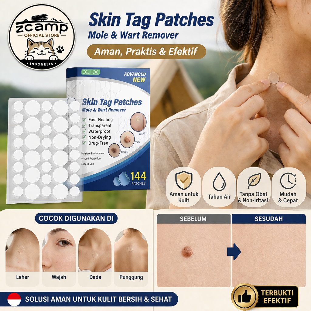 ZCAMP Skin Tag Remover Patch 144pcs – Hilangkan Kutil, Tahi Lalat & Daging Tumbuh Secara Alami, Tida