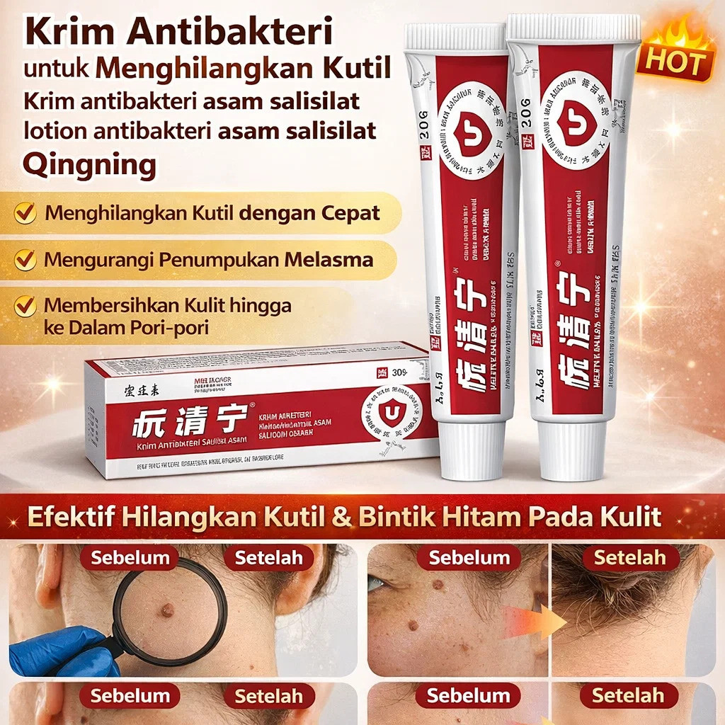 GRATIS ONGKIR - Salep Penghilang Kutil Asam Salisilat/ Salep Anti Bakteri Penghilang Kutil/ Perawata