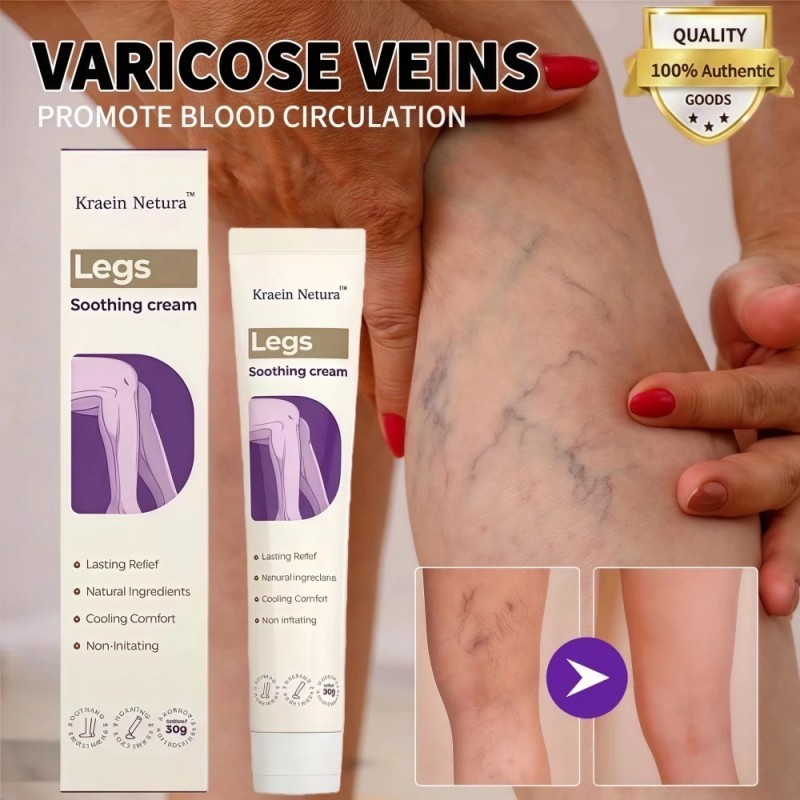 Obat Varises varicose veins cream salep varises salep varises paling ampuh penghilang varises di kak