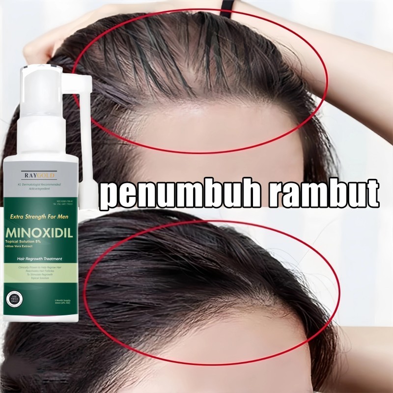 MINOXIDIL 5% penumbuh rambut & brewok with Aloe Vera for MEN made in USA - RAYGOLD - MINOX MINOKSIDI