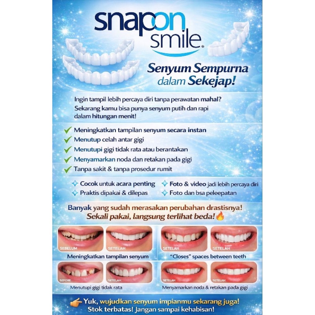 Paling Laris Snap on smile sepasang/snap on smile Gigi palsu veneer Sepasang gigi atas bawah _Asli P