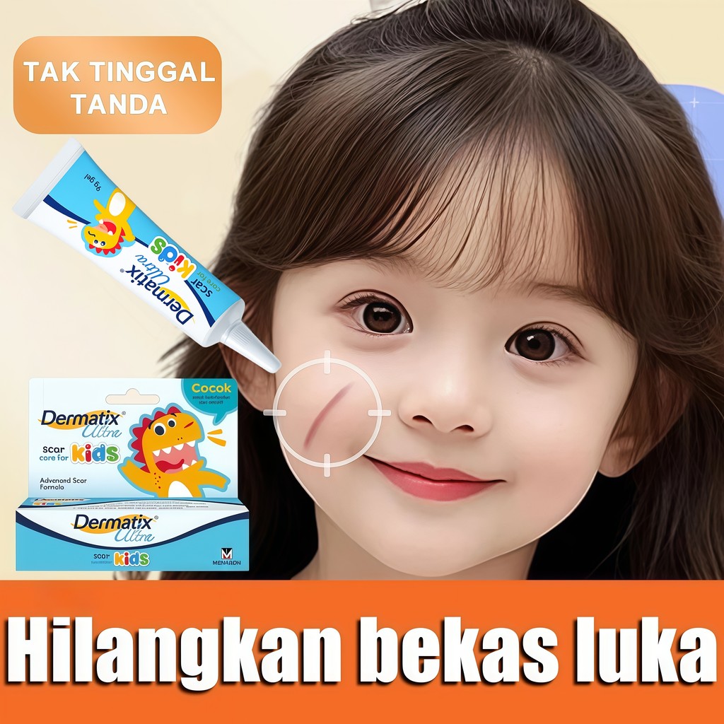 Dermatix Ultra Kids 9g Gel Perawatan Bekas Luka Anak Bayi, Hilangkan Bekas Luka Jatuh Gores Baru & L