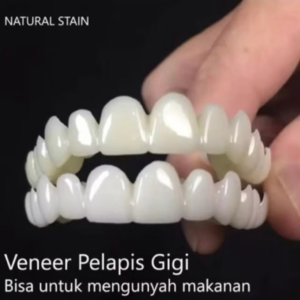 Mega Sale ~ GIGI PALSU 1 SET ATAS BAWAH SNAP ON SMILE VINET GIGI 100% ORI
