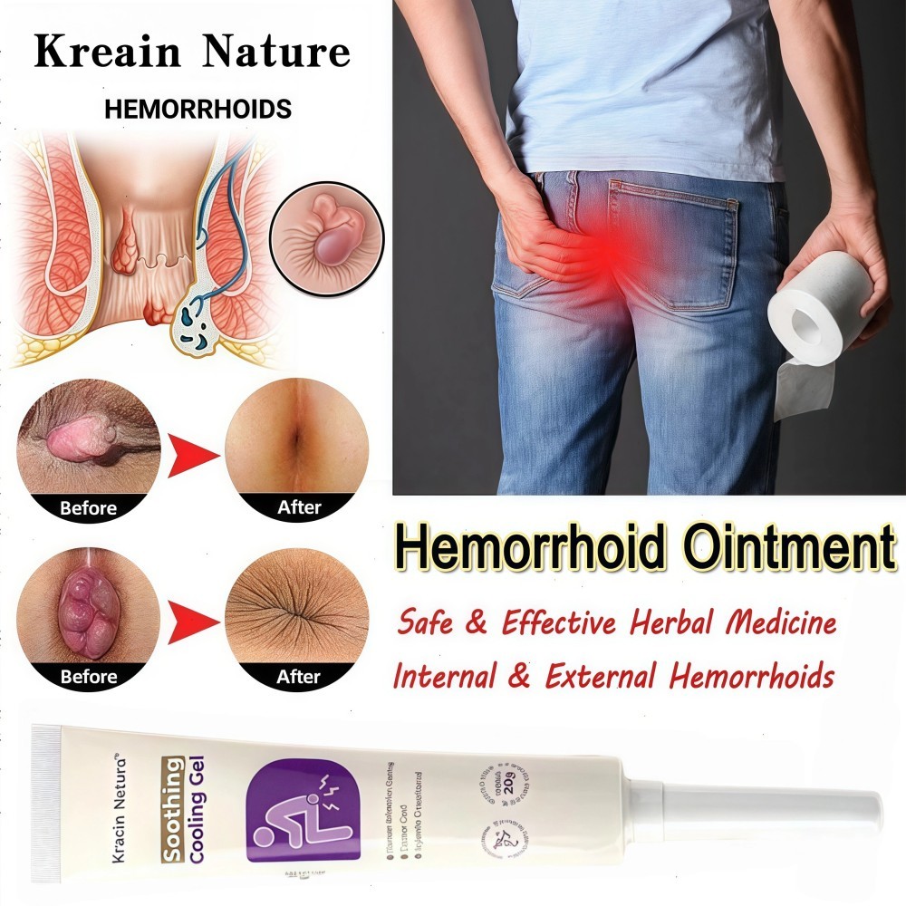 Obat wasir Salep wasir Salep ambeien paling ampuh 20g Ekstrak herbal untuk menghilangkan ambeien Was