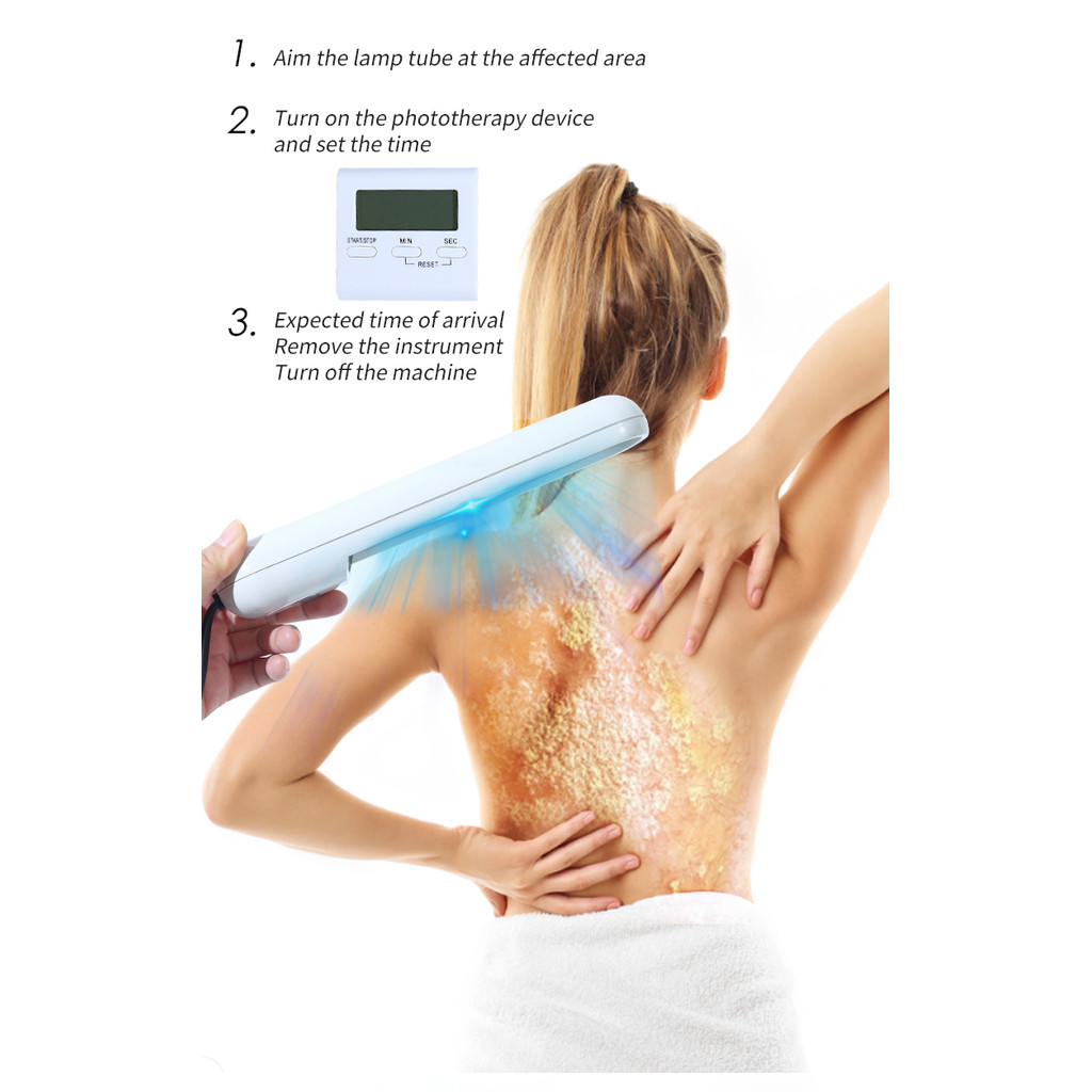 UVB Ultraviolet Phototherapy Instrument Vitiligo Treatment Ultraviolet Lamp Laser Psoriasis Lamp Pho