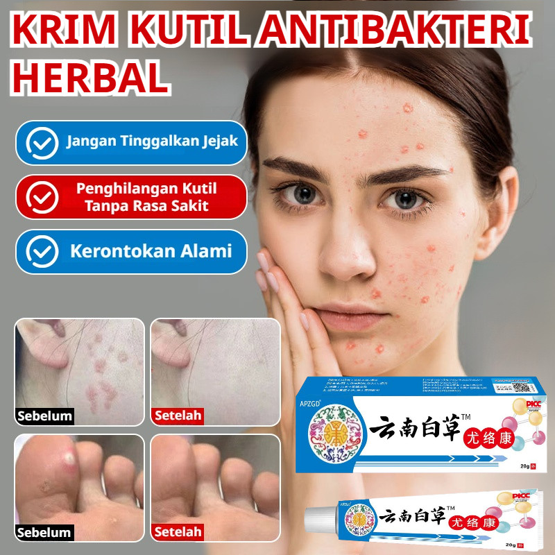 KKrim Kutil Antibakteri Herbal 60 Ml / Salep Penghilang Kutil Herbal / Larutan Penghilang Kutil Dan 