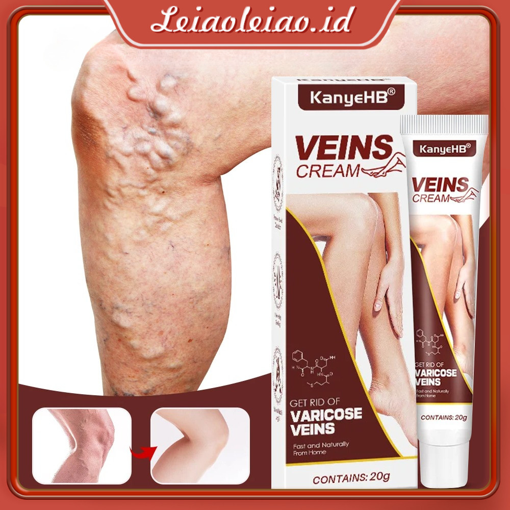 KanyeHB Maikang Cream Varicose Veins | Salep Varises 20g Paling Ampuh untuk Varises / Vaskulitis / F