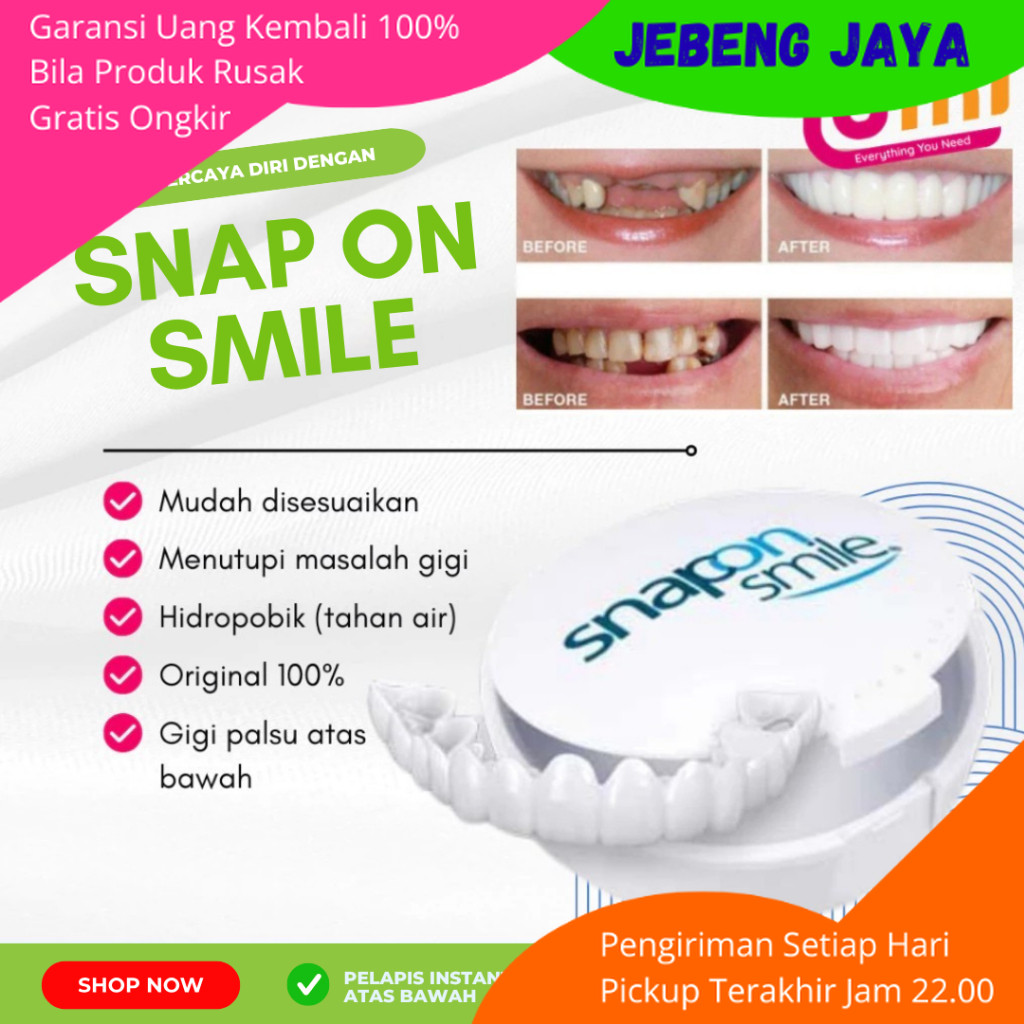 Gigi Palsu Estetik Snap On Smile Veneer Instan Set Atas Bawah Penutup Gigi Renggang Tebal Tipis Flek