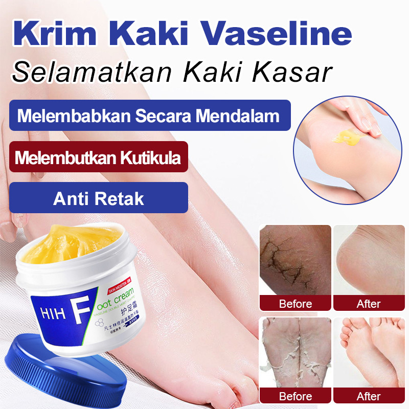 [Perawatan Kaki] Krim Kaki Vaseline Pelembab Intensif / Perawatan Kaki Kering Dan Pecah-pecah / Krim