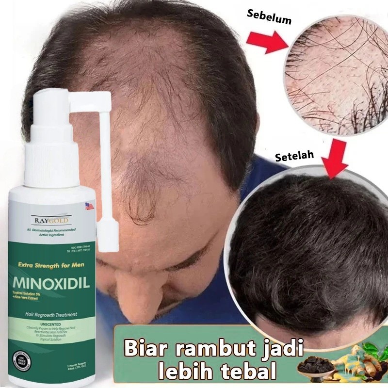 MINOXIDIL 5% penumbuh rambut & brewok with Aloe Vera for MEN made in USA - RAYGOLD - MINOX MINOKSIDI