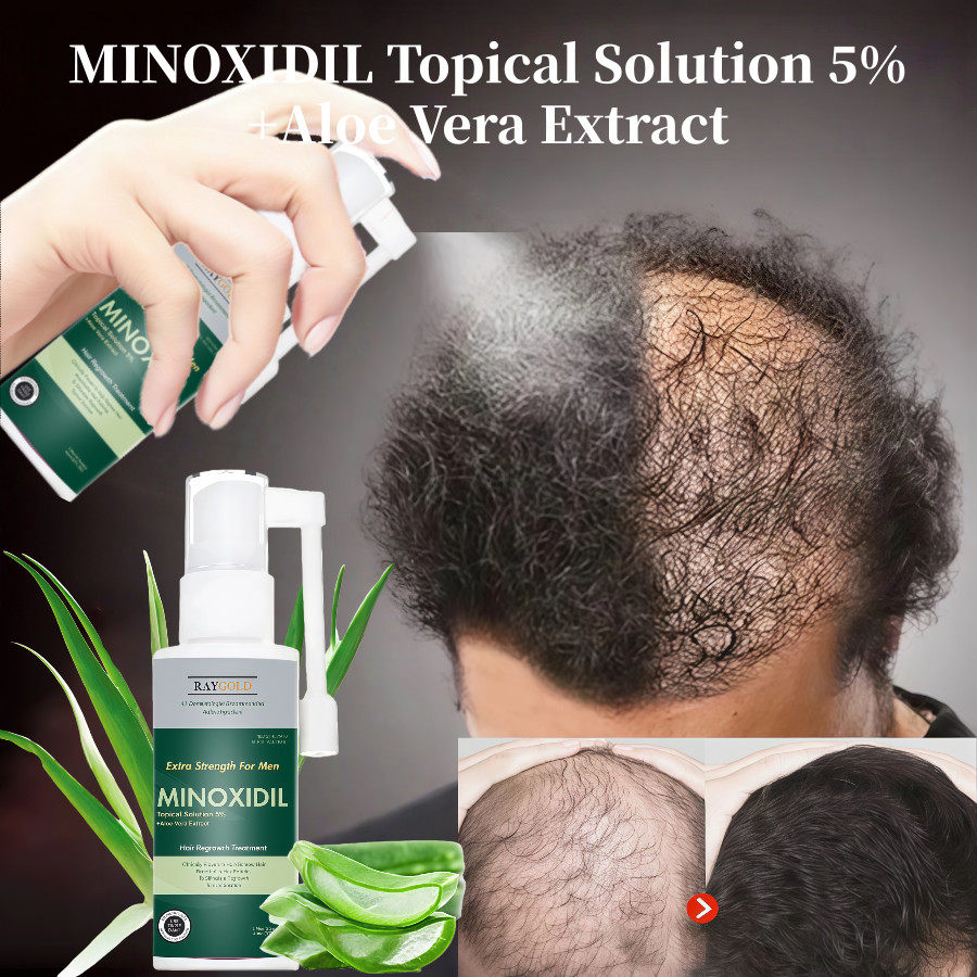 MINOXIDIL 5% penumbuh rambut & brewok with Aloe Vera for MEN made in USA - RAYGOLD - MINOX MINOKSIDI