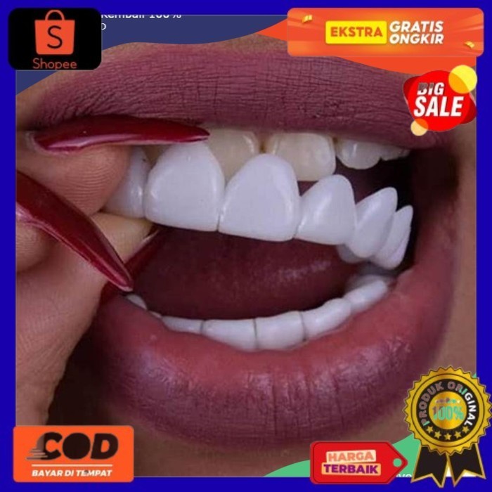 Paket Gigi Palsu Snap on Smile Pria dan Wanita Atas Bawah