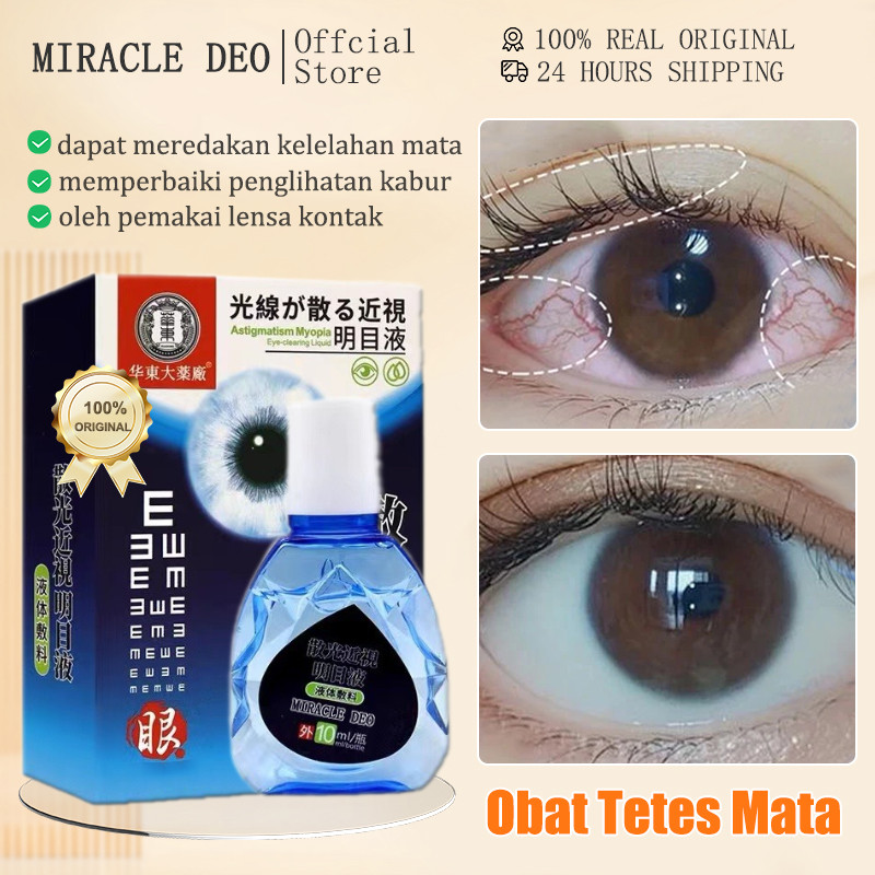 MIRACLE DEO Obat Tetes Mata Obat Mata Katarak Eye Drop Tetes Mata Katarak Obat Sakit Mata Obat Mata 