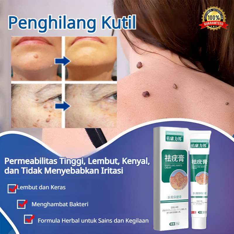 Salep penghilang kutil / Terapi kutil herbal / Krim penghilang kutil / Salep anti kutil / Perawatan 