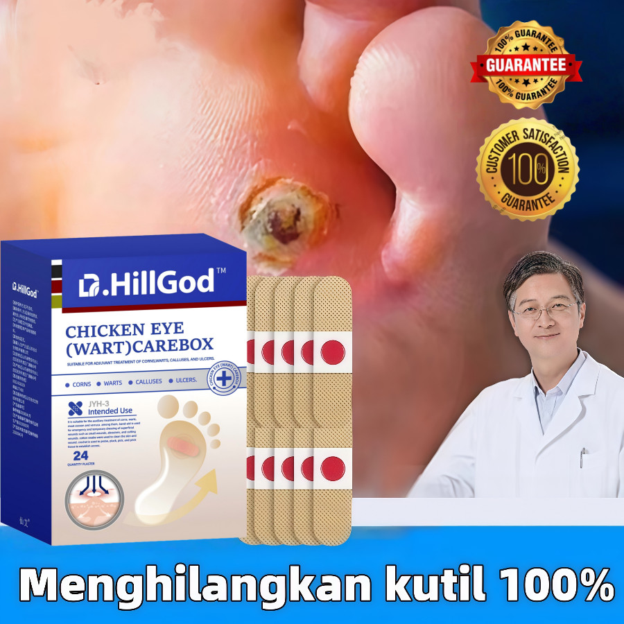 [100% Ampuh] Plester Kutil Mata Ikan Obat Kutil Mata Ikan Tahi Lalat Plester Kutil Penghilang Pencab