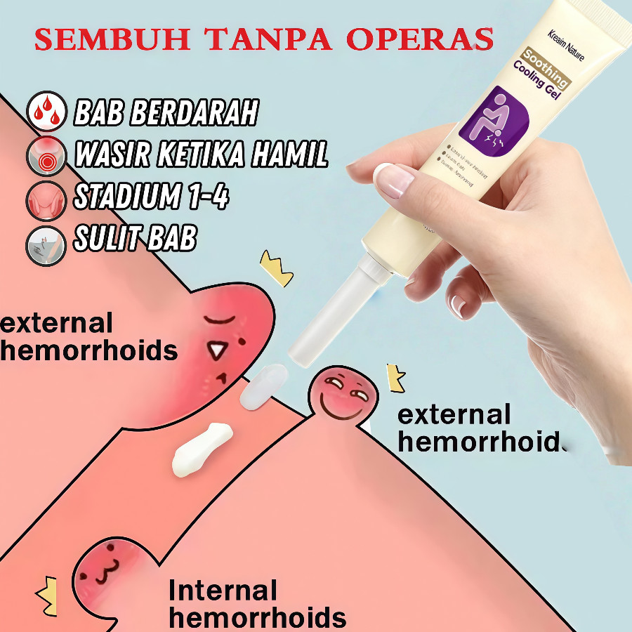Obat wasir Salep wasir Salep ambeien paling ampuh 20g Ekstrak herbal untuk menghilangkan ambeien Was