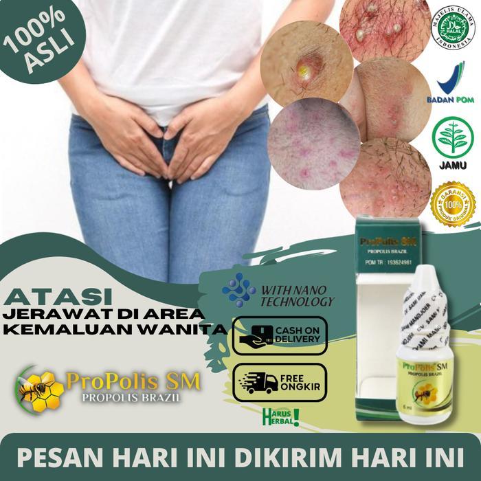 Obat Jerawat di Area Kemaluan Wanita, Bintik Gatal Di Bulu Kemaluan