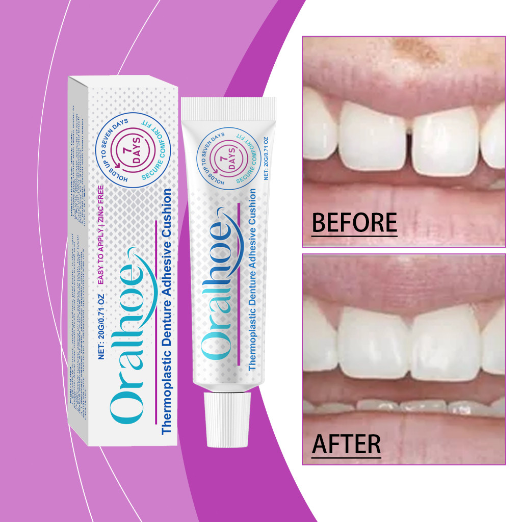 Oralhoe lem perekat gigi palsu 20g lem gigi palsu tahan lama perekat gigi palsu ke gusi lem gigi goy