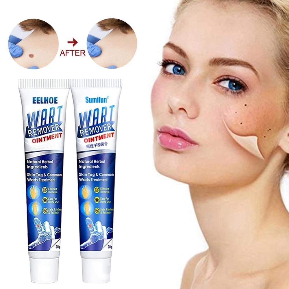Sumifun EELHOE Wart Remover Cream Herbal Natural Ampuh Menghilangkan Kutil Dan Tahi Lalat Terlaris