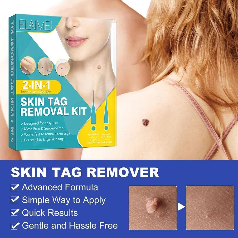 Double Sided Wart Treatment Face Skin Tag Removal Tool Ae Tag Remover Face Skin Tag Removal Pat
