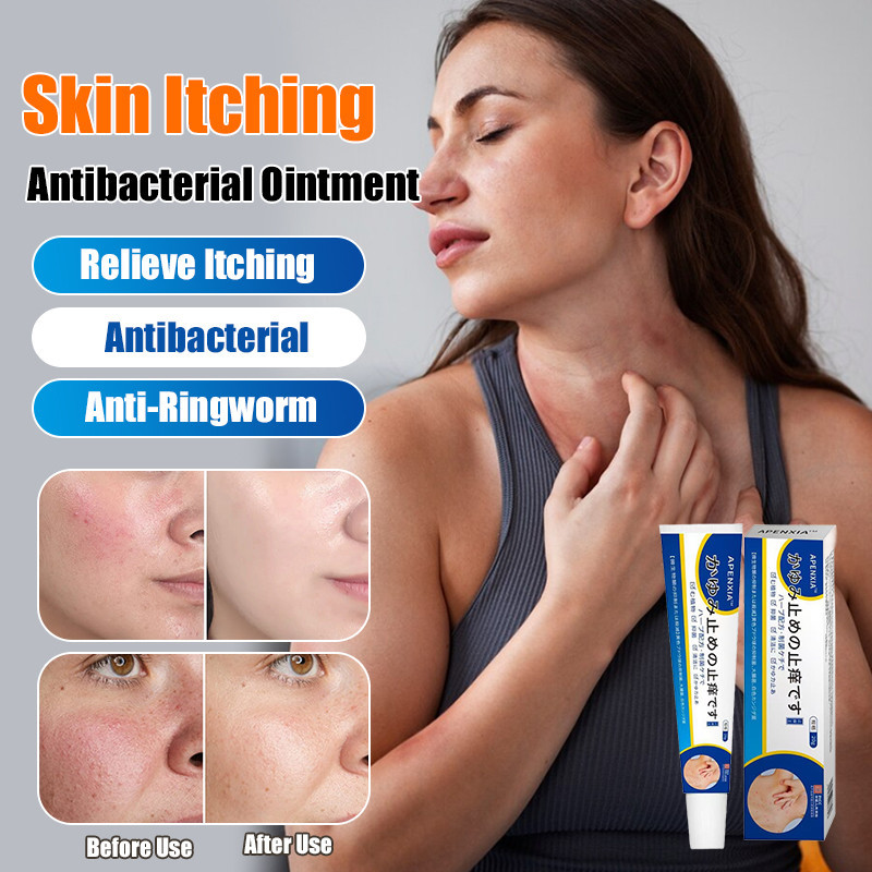 COD+Kirim Dalam 24 Jam/[Redakan Gatal & Iritasi Kulit dengan Cepat] Salep Anti-gatal Dan Antibakteri