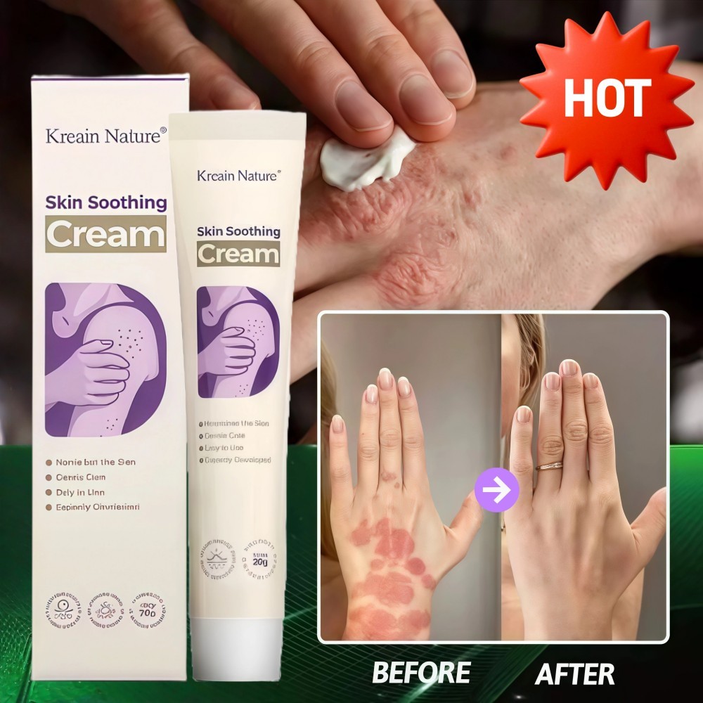 Skin Soothing Cream Krim menenangkan kulit efektif mengurangi ruam dan gatal Darurat untuk meringank
