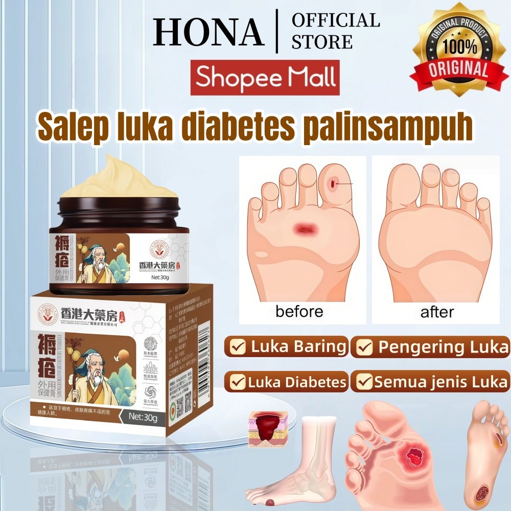 HONA - Krim Luka baring/Penyembuhan luka/Luka diabetes/ Krim dekubitus/Mengobati dekubitus 30g