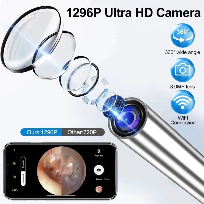 Korek Kuping Kamera Wireless LED Smart / Pembersih Telinga Korek Kuping Kamera Led Wireless