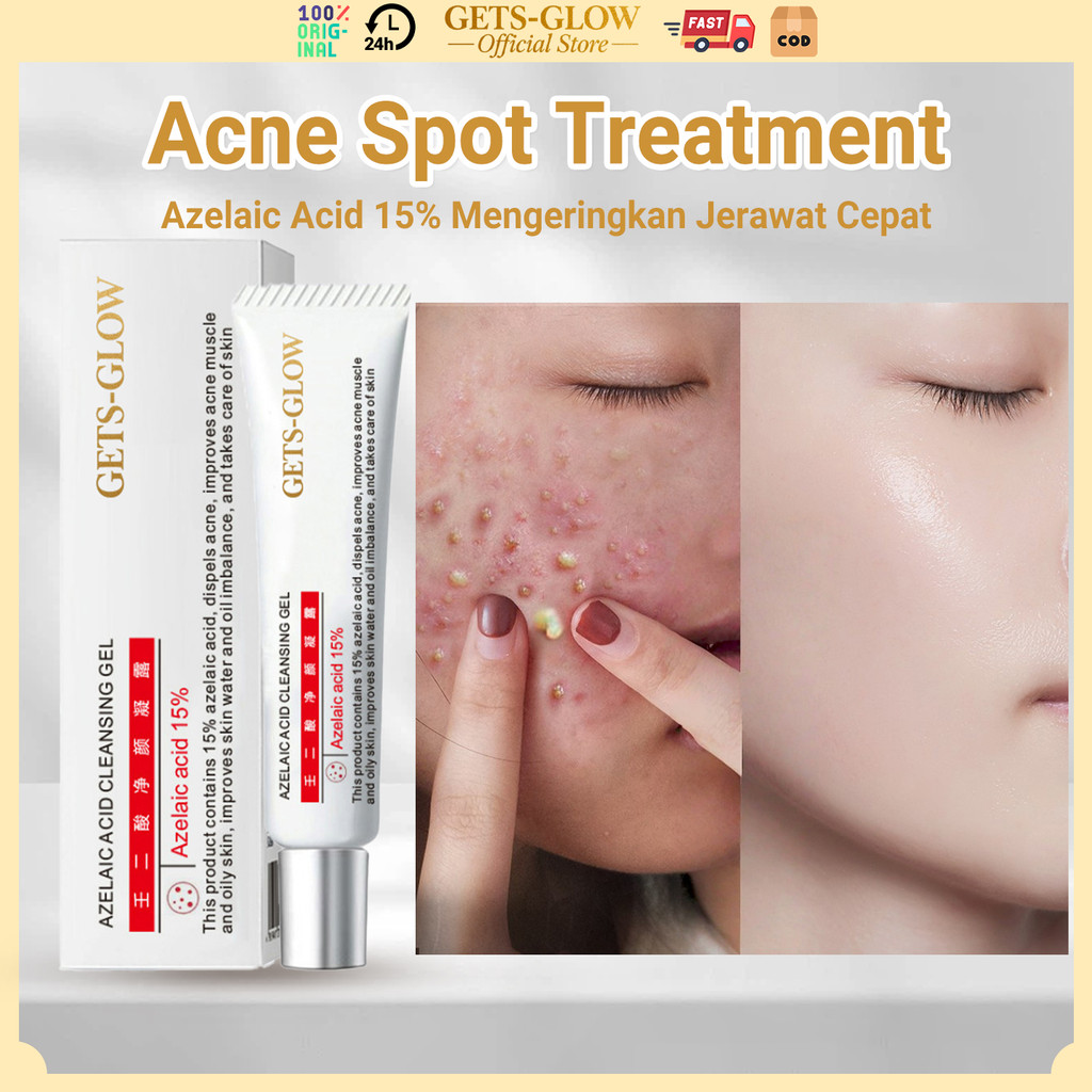 GETS-GLOW Acne Spot Treatment Azelaic Acid 15% 15g Obat Totol Jerawat Ampuh Mengeringkan Jerawat Dal
