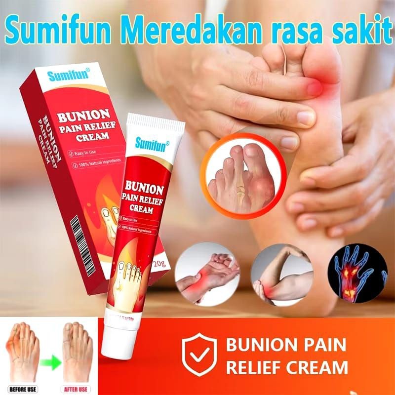 [ ORIGINAL 100%]  Salep Rematik Sumifun Bunion Pain Relief Cream Splint Jari Kaki Hallux Valgus Pere
