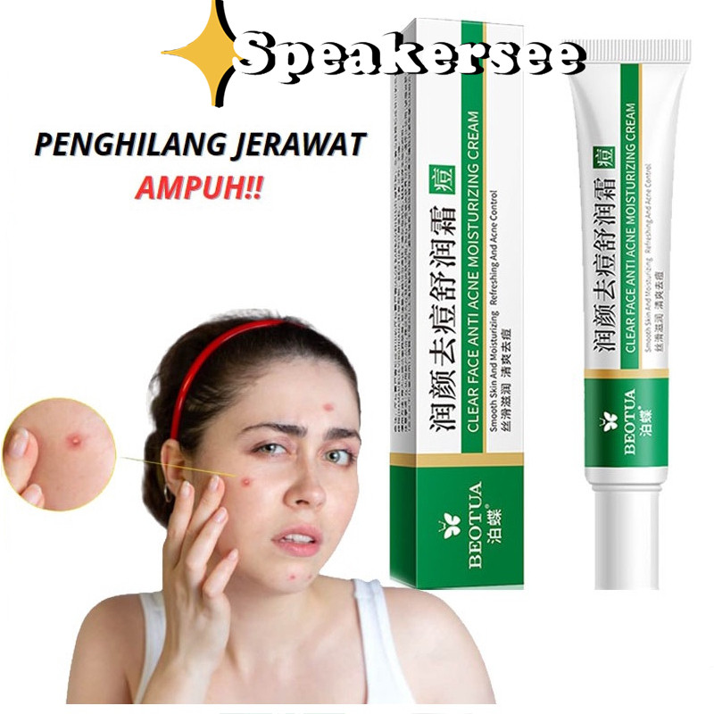 Cindynal X BEOTUA Salep Obat Paling Ampuh Mengatasi Jerawat Terparah