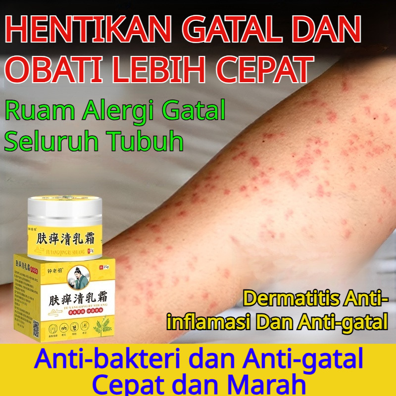 Krim Pereda Gatal | Krim Herbal Pereda Gatal | Krim Kaki Atlet | Perawatan Gatal/Kaki Atlet
