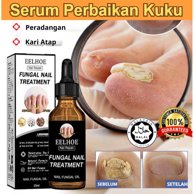 Cairan Penghilang Dan Perbaikan Jamur Kuku/Cairan Perawatan Bergizi/ Penebalan Dan Pencerah Kuku/ Ca