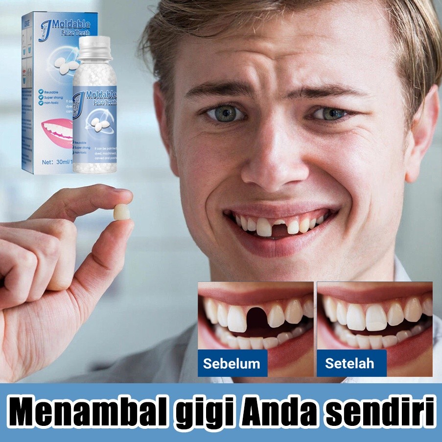 Gigi palsu Penambal gigi Palsu Gigi Temporary Butir Penambal Gigi gusi gigi palsu lem gigi palsu per