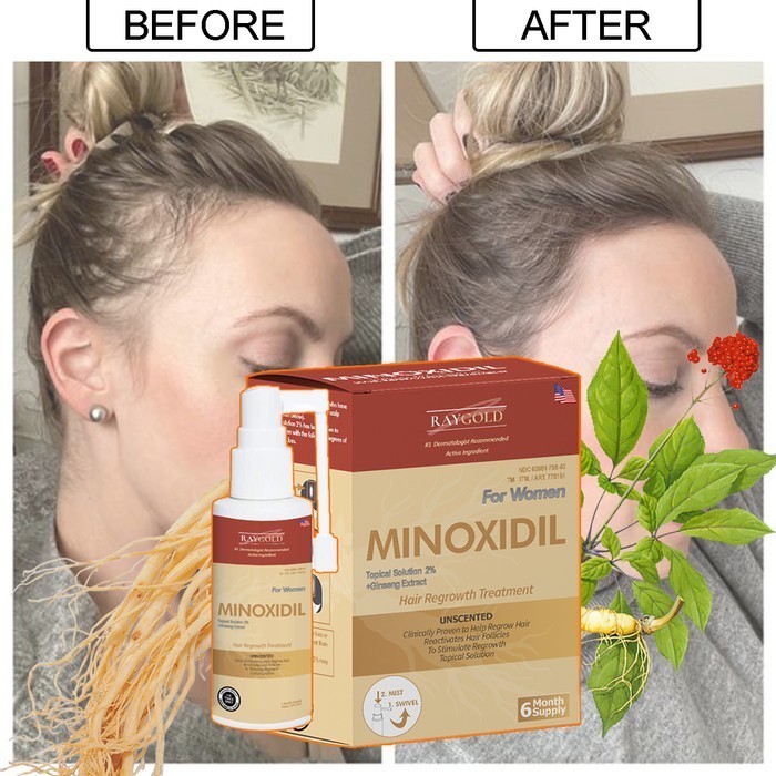 MINOXIDIL5%for WOMEN penumbuh rambut with Ginseng extract from USA  - RAYGOLD - MINOX MINOKSIDIL ant