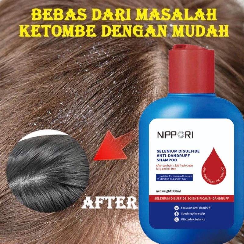 Selenium Disulfide Anti Dandruff Shampoo 300ml Anti Gatal Pengobatan Ketombeshampoo Penghilang Ketom
