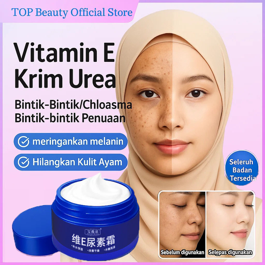 70g Vitamin E Krim Urea Penghilang Noda Dengan/Penghilang Bintik-Bintik Serum Wajah Vitamin E Bintik